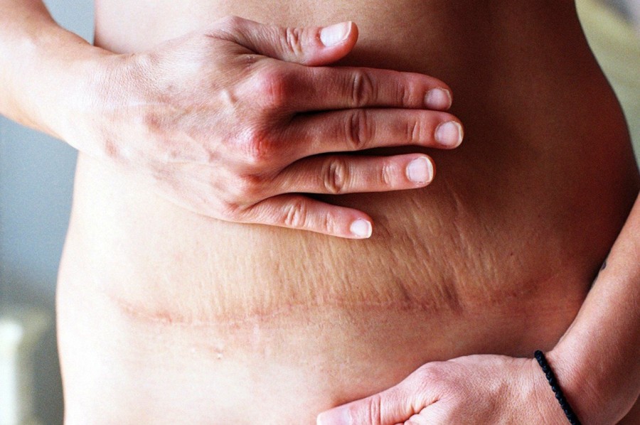 82 νέοι φωτογράφοι της πόλης σε μια υπαίθρια έκθεση στη Νέα Παραλία - Φωτογραφία 6