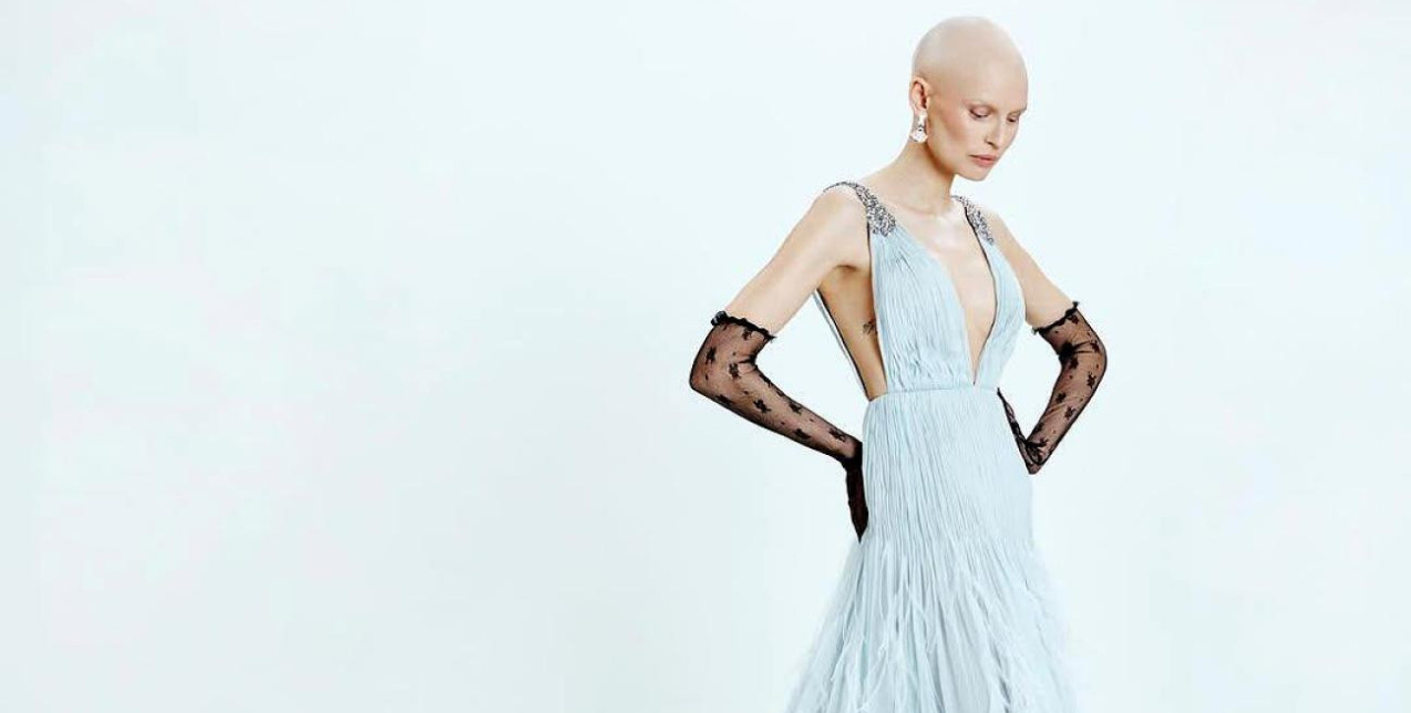 Bianca Balti: H Victoria’s Secret αρνήθηκε να συμμετάσχει στο show κατά τη διάρκεια της μάχης της με τον καρκίνο