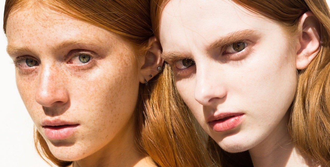 Skin Peels: Όσα πρέπει να γνωρίζετε για το πήλινγκ και τα οξέα προσώπου 