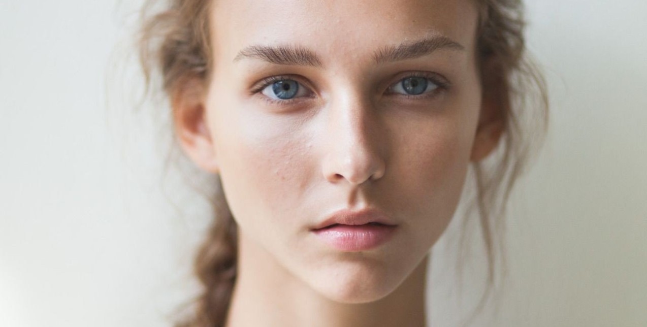 Ταλαιπωρείστε από μαύρους κύκλους; Αντιμετωπίστε τους με αυτούς τους φυσικούς τρόπους 