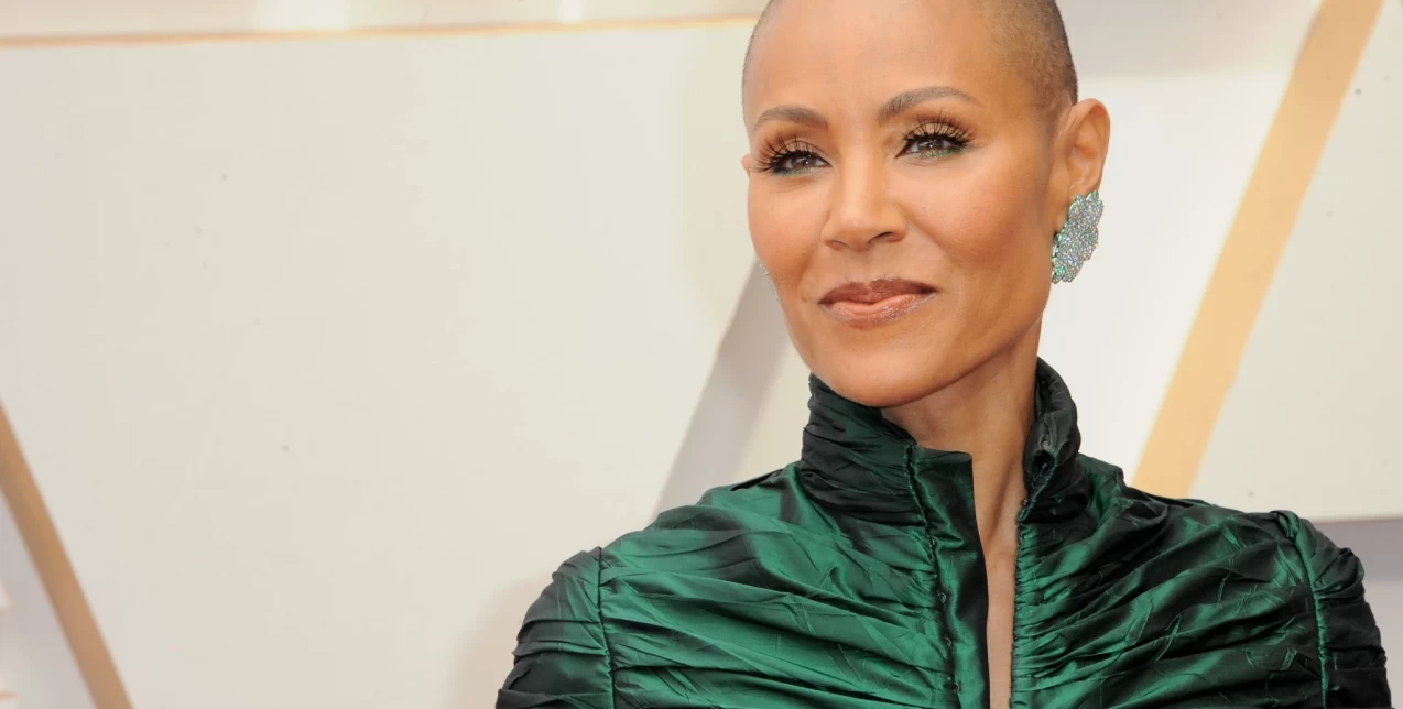 Αλωπεκία: Τι ακριβώς είναι η ασθένεια της συζύγου του Will Smith; 