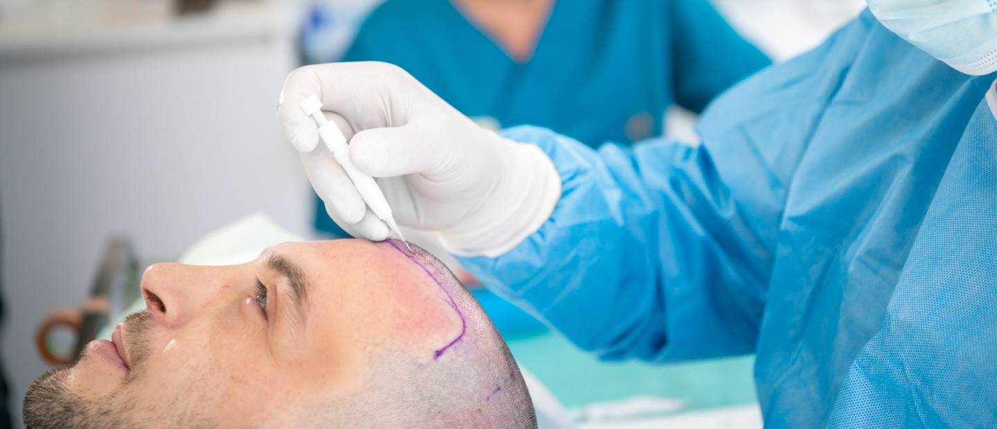 Η κλινική μεταμόσχευσης μαλλιών στην καρδιά της Θεσσαλονίκης που εφαρμόζει μια από τις πλέον καινοτόμες τεχνικές παγκοσμίως