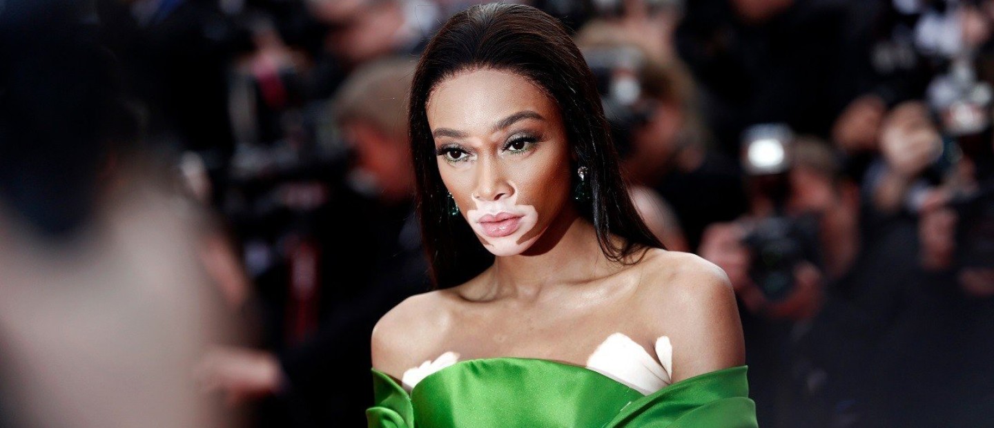 Αυτές είναι οι πρωινές συνήθειες του supermodel, Winnie Harlow