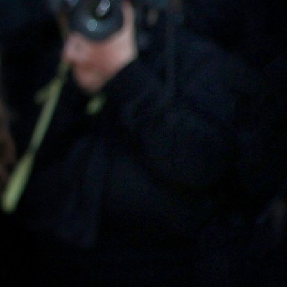 Botox brow lift: Οι συμβουλές των ειδικών που πρέπει να γνωρίζετε