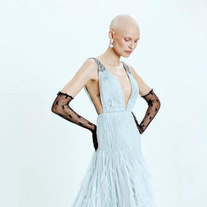 Bianca Balti: H Victoria’s Secret αρνήθηκε να συμμετάσχει στο show κατά τη διάρκεια της μάχης της με τον καρκίνο