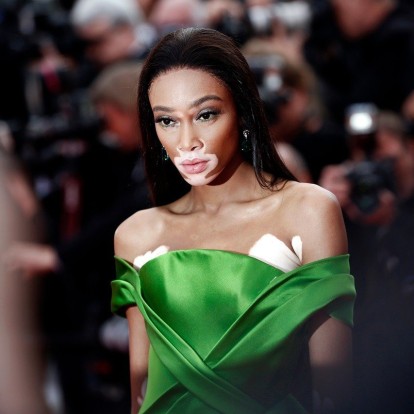 Αυτές είναι οι πρωινές συνήθειες του supermodel, Winnie Harlow